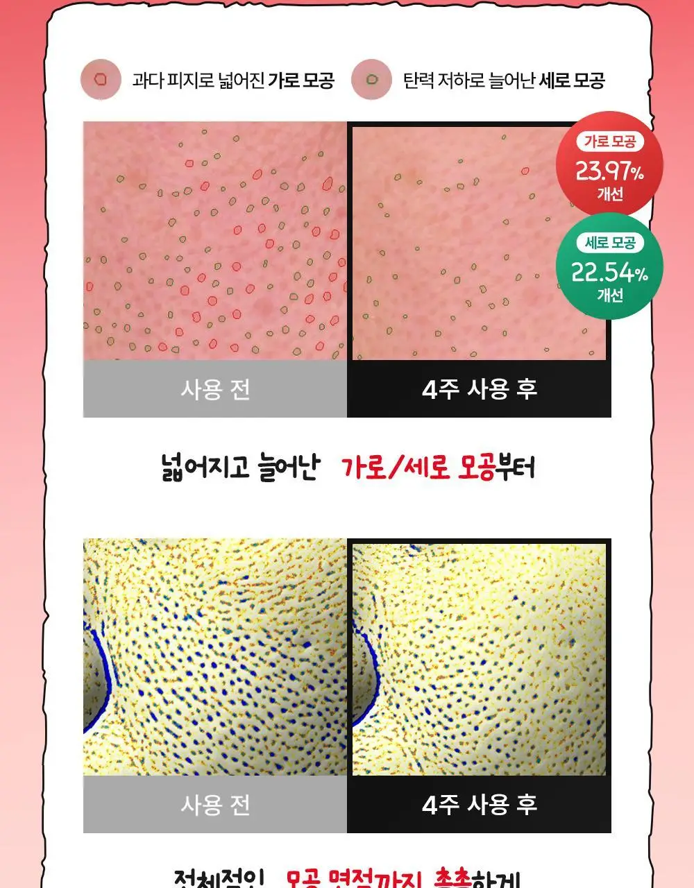 [모공PDRN 집중케어썬/조앤프렌즈 콜라보] 셀퓨전씨 레이저 UV 포어 썬 세럼 40ml 상세페이지 25